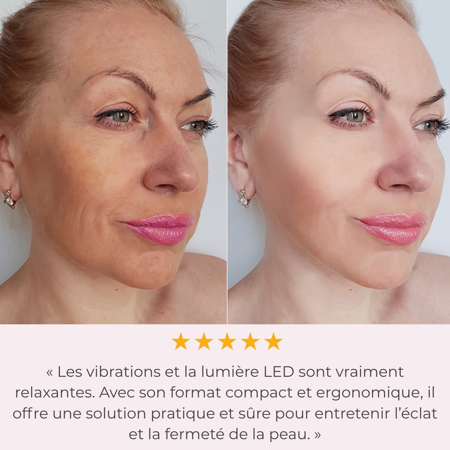 LumiLiFt 7 - Appareil de raffermissement du visage