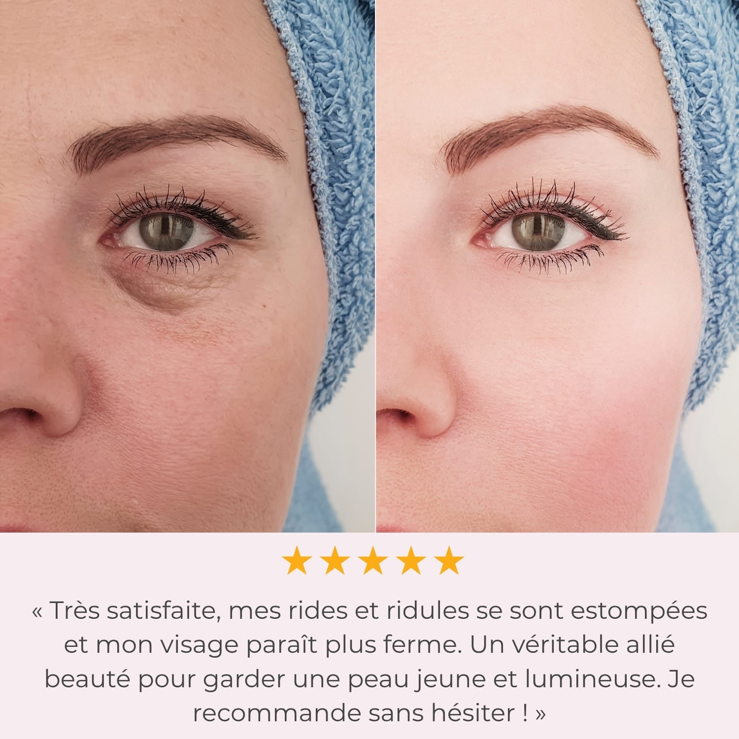 LumiLiFt 7 - Appareil de raffermissement du visage