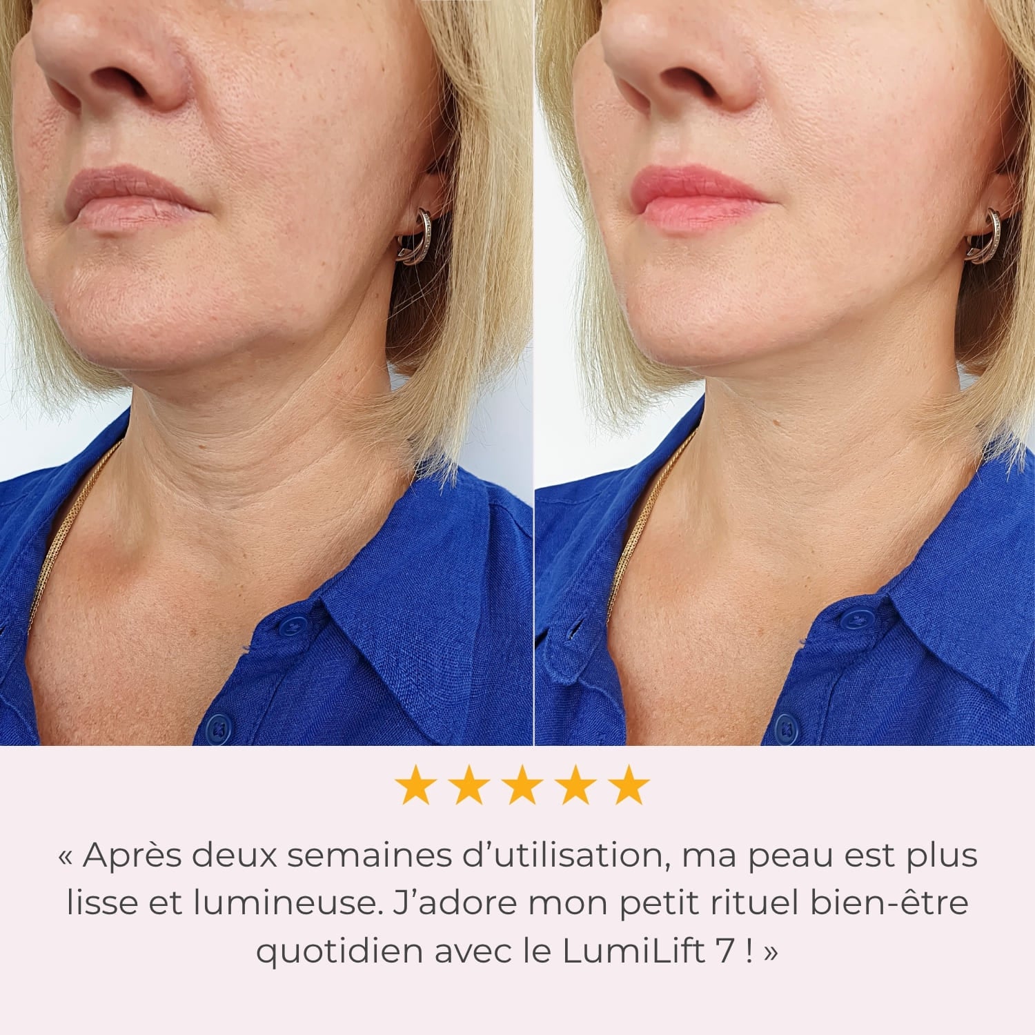 LumiLiFt 7 - Appareil de raffermissement du visage
