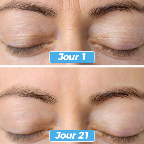 Glowskin Pro2 - Masque LED Soin Visage & Cou