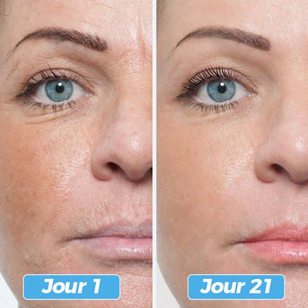 Glowskin Pro2 - Masque LED Soin Visage & Cou